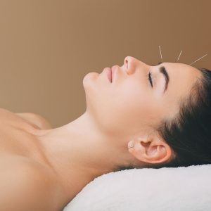 facial rejuvenation acupuncture